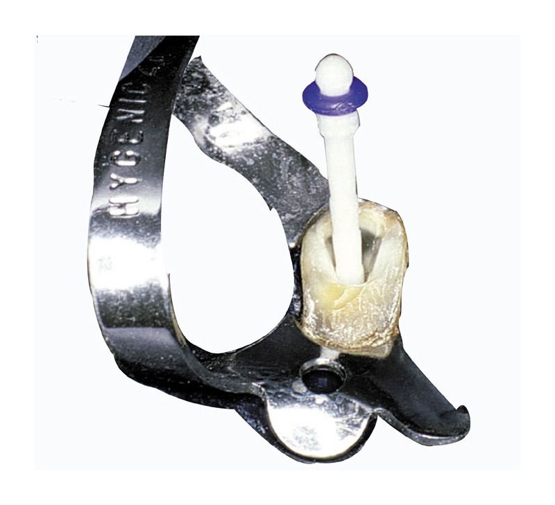 PARAPOST FIBER WHITE KIT INTRO PF-160      COLTENE