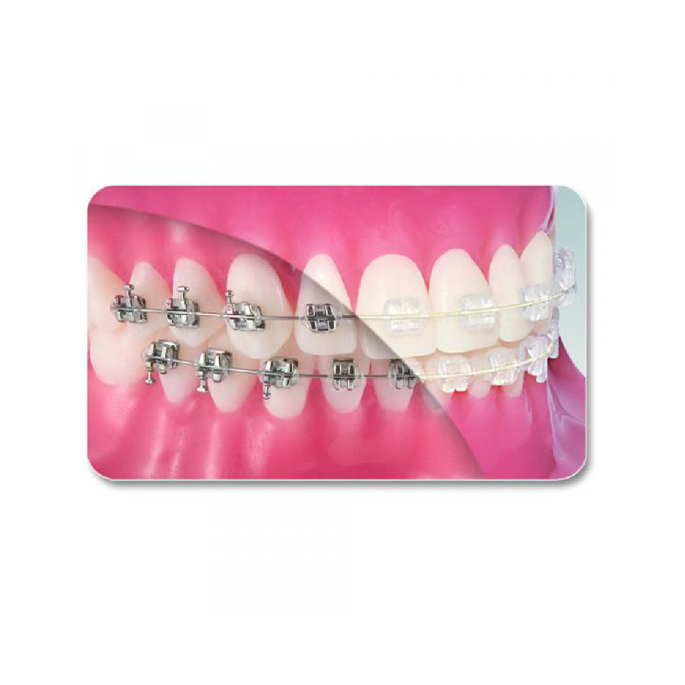 Arcs orthodontique NiTi - rectangle (10)