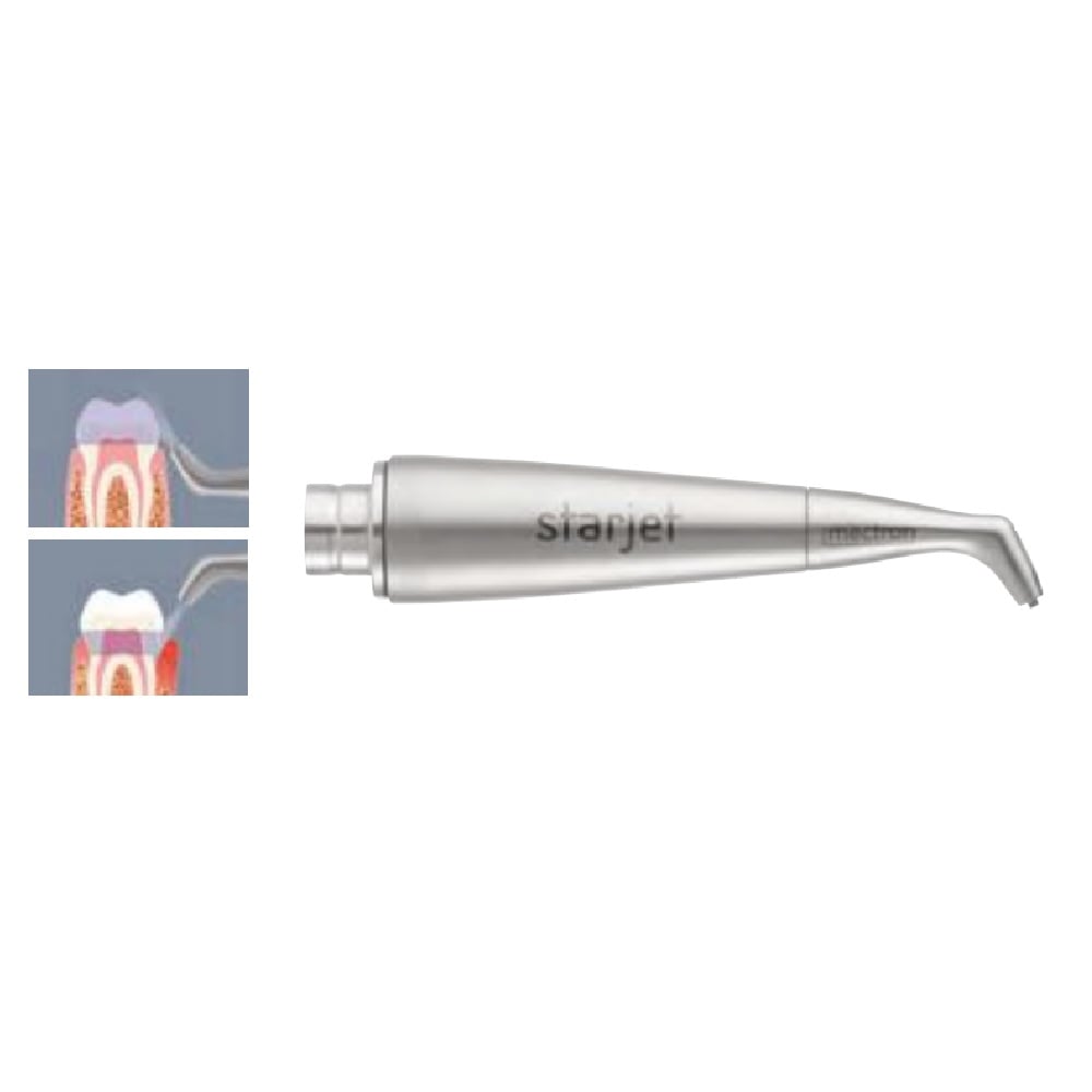 Buse aéropolissage 120°