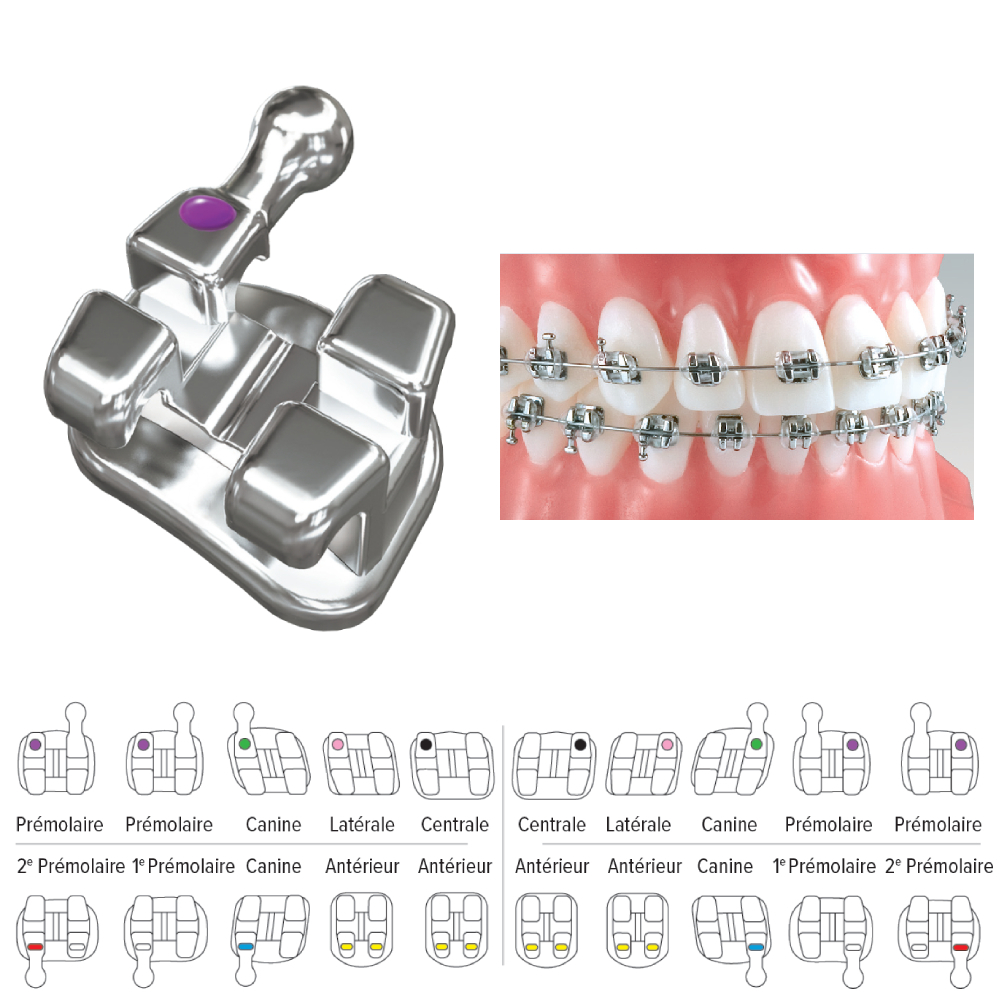 Brackets Maxillaires Votion Méthode Roth