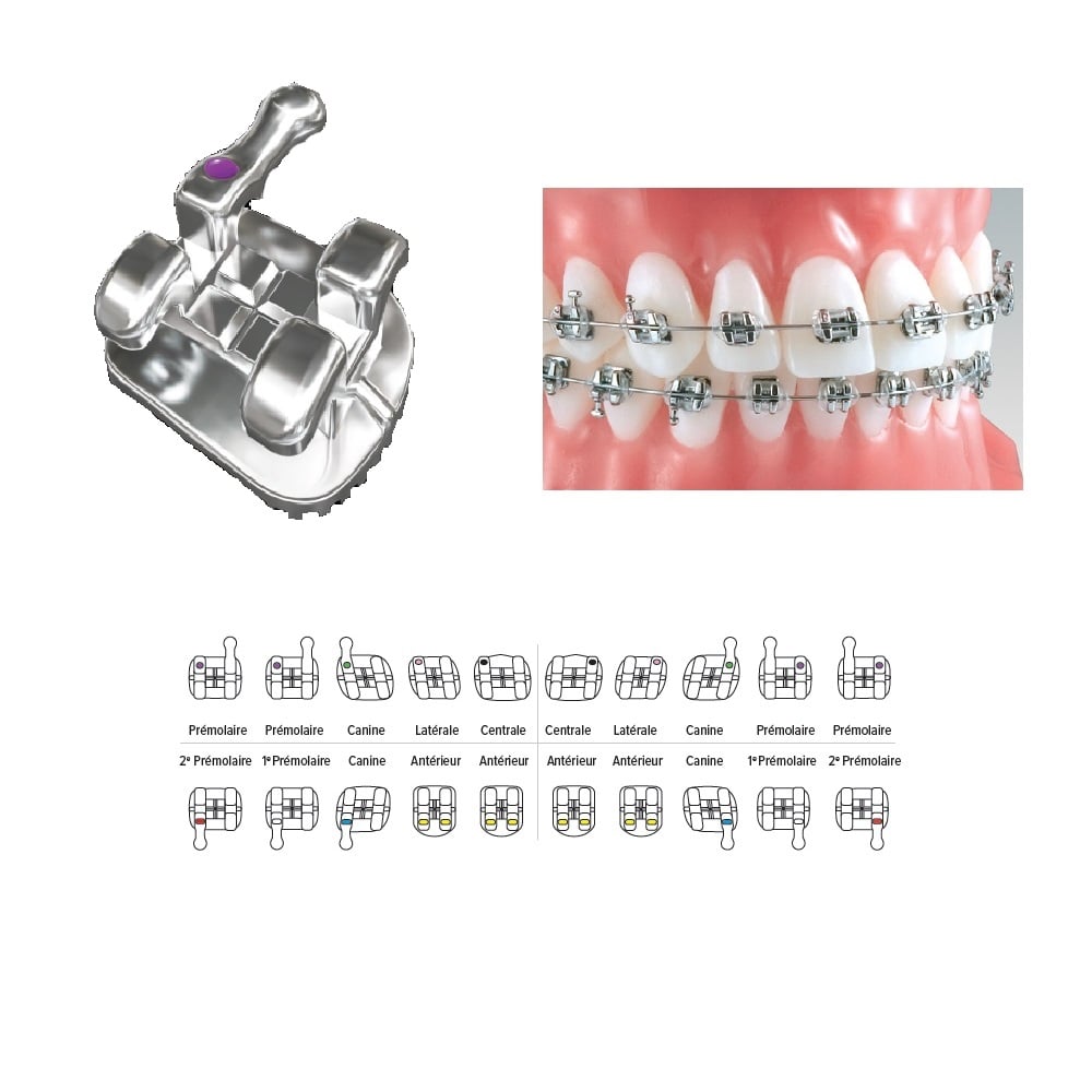 Brackets Pinnacle Sans Torque Méthode MBT (Kit Patient)
