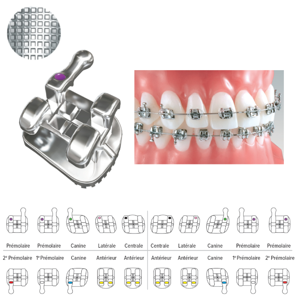 Brackets Maxillaires Pinnacle Méthode Roth
