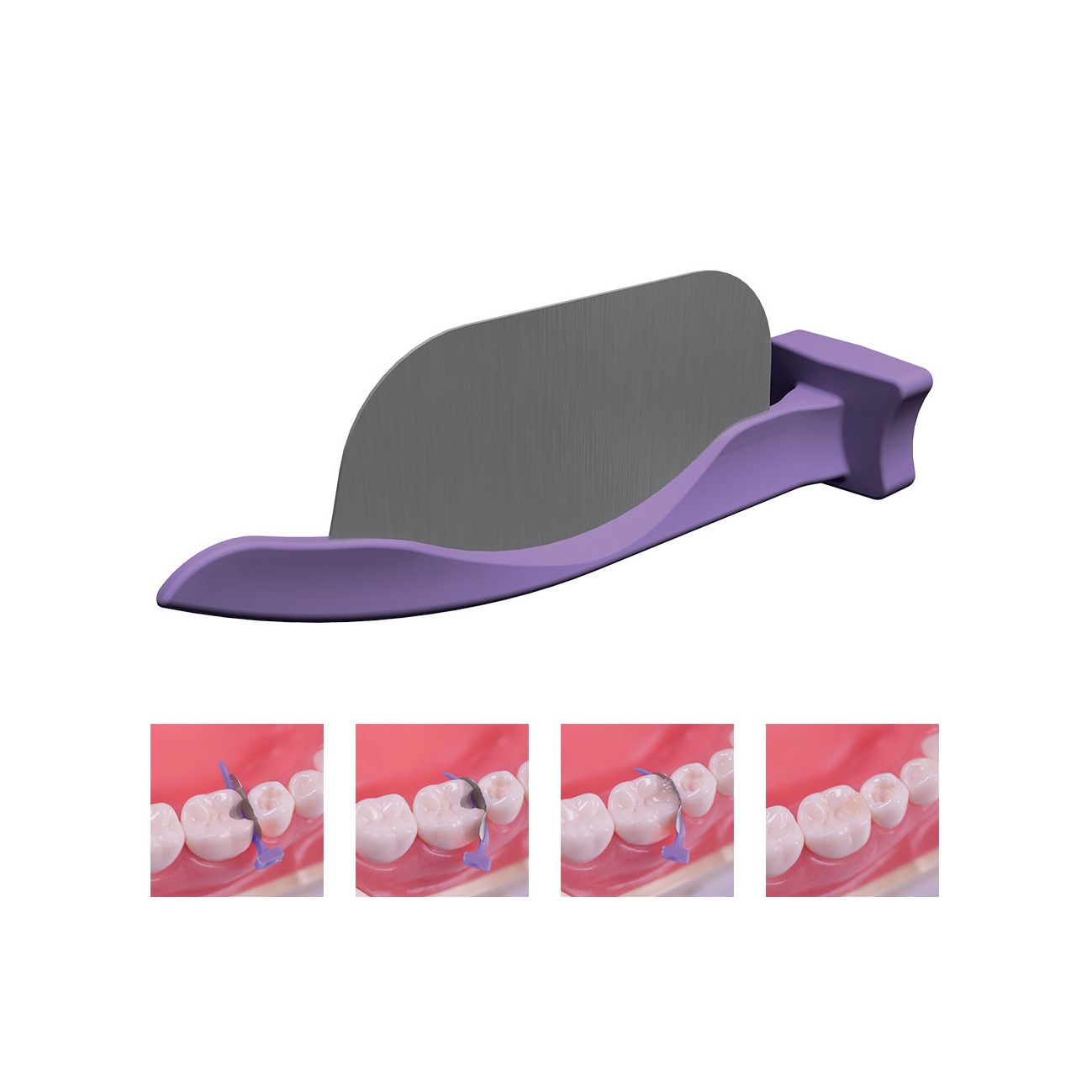 FENDER MATE TEMP    602786             DIRECTA