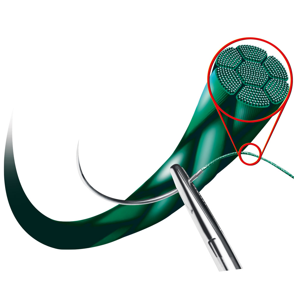 Fils de suture en soie noire tressée 3/0 3/8 19mm  (12)