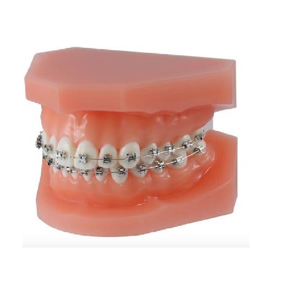 Modèle de démonstration orthodontique M51
