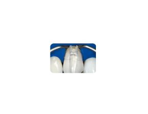 Matrices Cervicales Transparentes Hawe