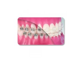 Arcs orthodontique NiTi - rond (10)