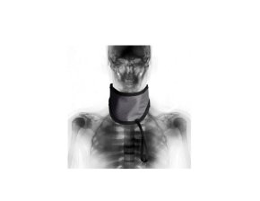 Protège thyroïde adulte TSSL
