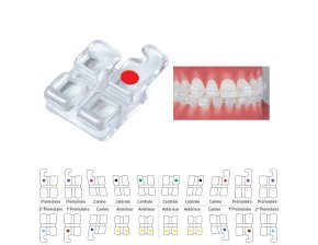 Brackets Maxillaires Pure Methode Roth (Recharge)
