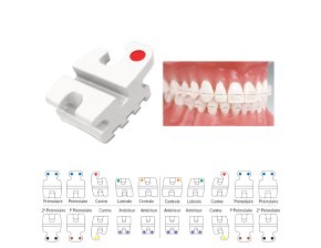 Brackets Maxillaires Reflection Methode Roth (Recharge)