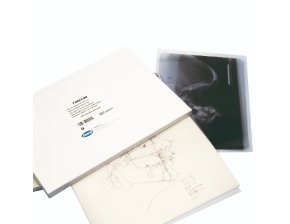 Feuilles acétate pour traçage céphalo (100)