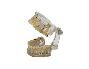 Modèle d'étude transparent Study Model